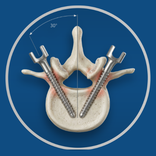 Percutaneous Pedicle Screw Fixation