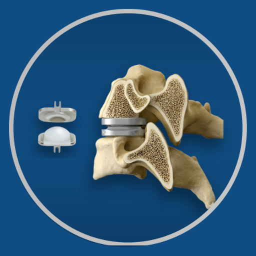 Cervical Disc Replacement