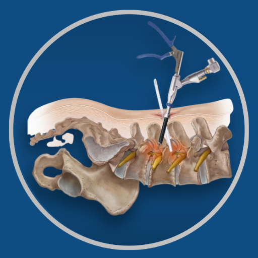 Endoscopic Spine Surgery