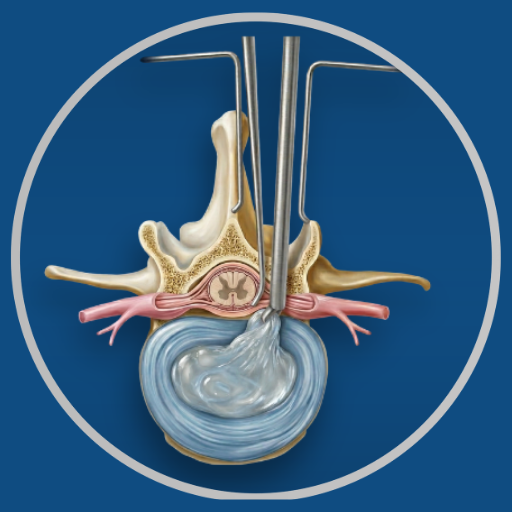 Discectomy